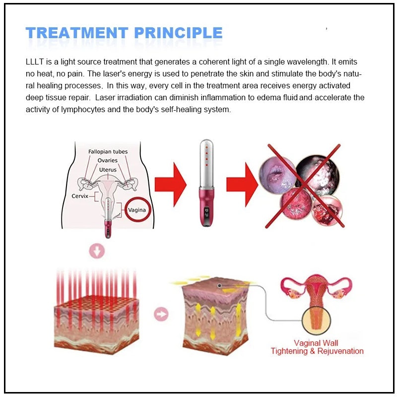 Laser Light Therapy Vagina Tightening & Health Wand